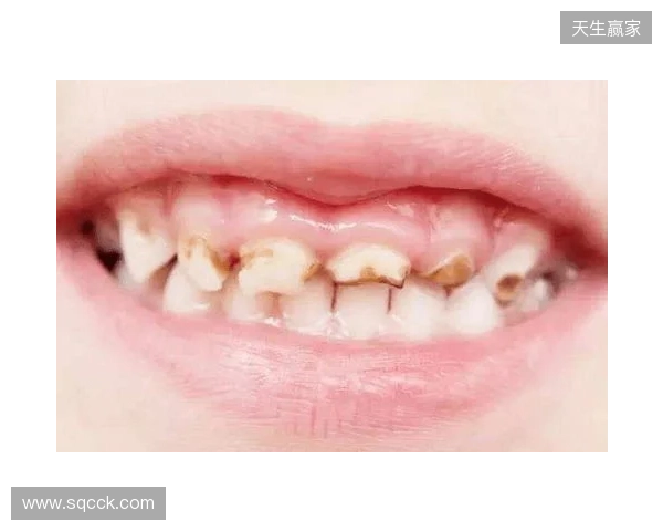 韦林顿确诊上唇部贯通伤；11、21牙半脱位；上颌前牙区牙槽骨骨折